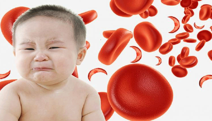 أهم 4+ أسباب وعلاج فقر الدم عند الأطفال