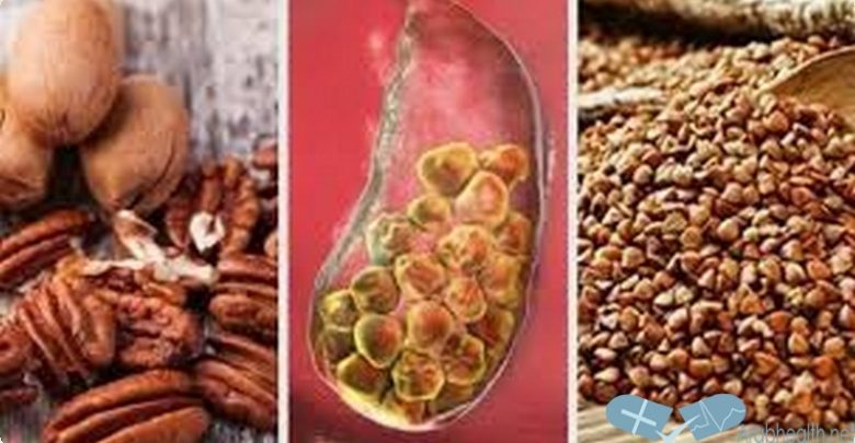 طرق علاج حصوات المرارة بالاعشاب 2025