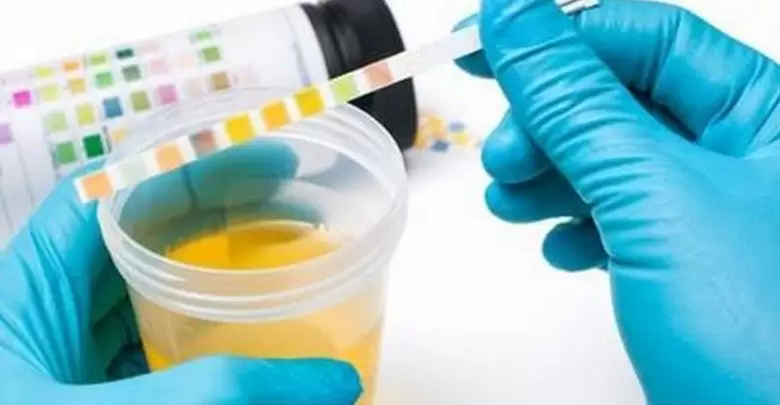 علاج صديد البول بالاعشاب 2025