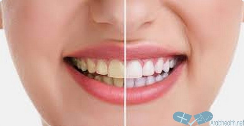 افضل 5+ طرق تبيض الاسنان طبيعية 2025
