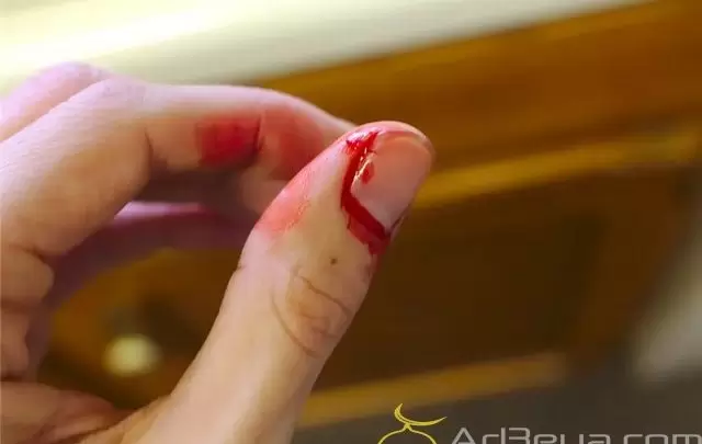 تفسير حلم الجرح في المنام لابن سيرين والنابلسي