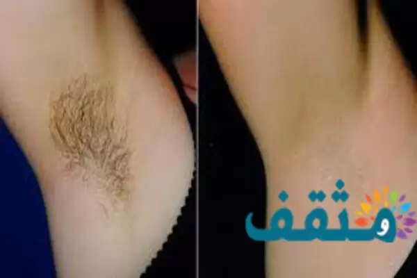 تفسير شعر الابط في في المنام لابن سيرين